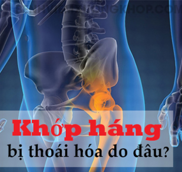 Tại sao bị thoái hóa khớp háng?